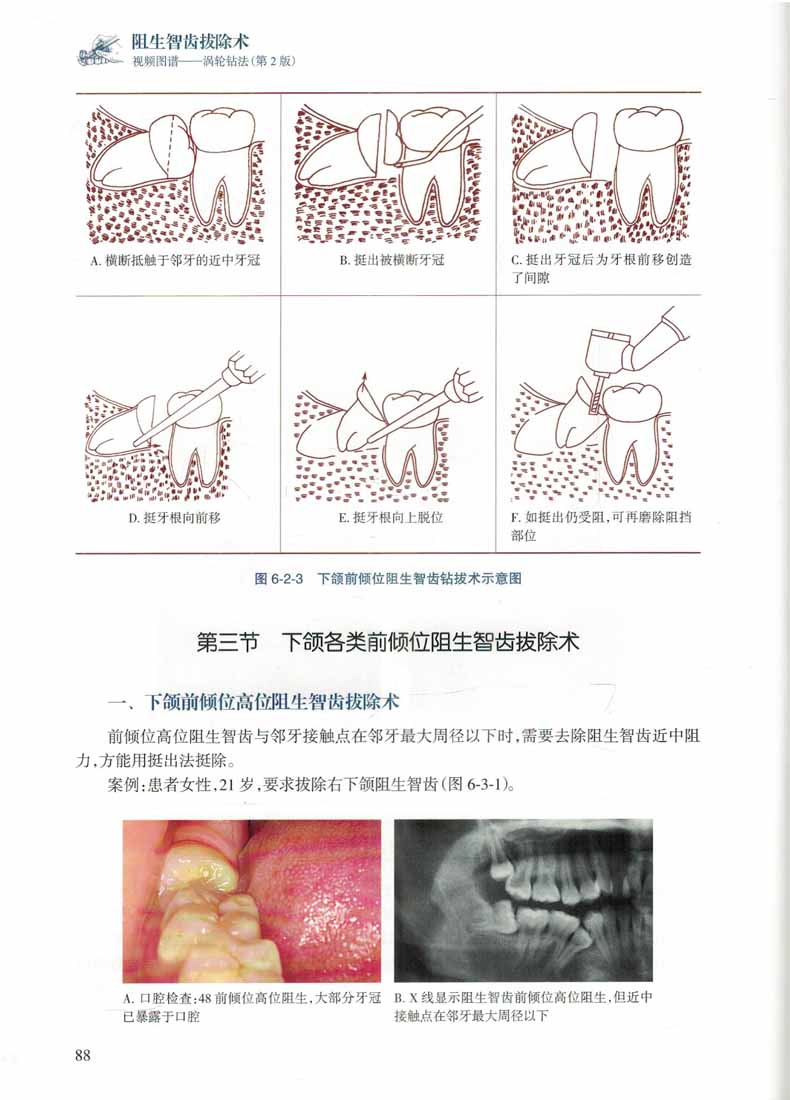 详情5.jpg
