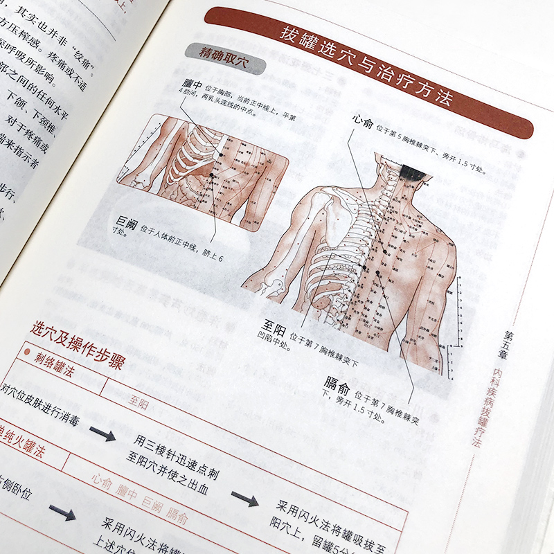 超簡單艾灸拔罐刮痧全書套裝3冊